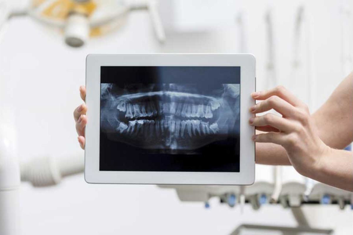 رادیوگرافی دندان، تجهیزات دندانپزشکی، پایا مدیکال